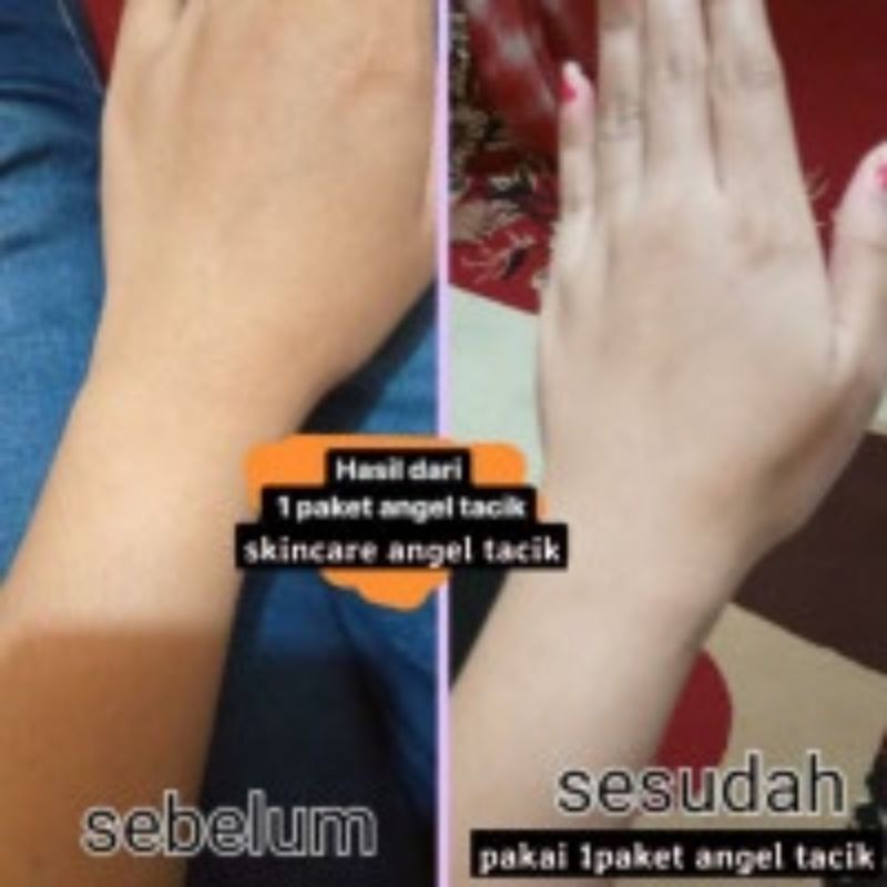 ANGEL TACIK KEMASAN BARU 300ML BODY LOTION PEMUTIH BADAN AMPUH BPOM