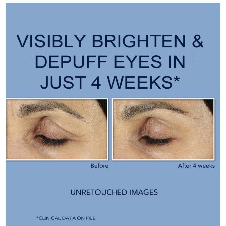 RoC Retinol Correxion Eye Cream 15 ML