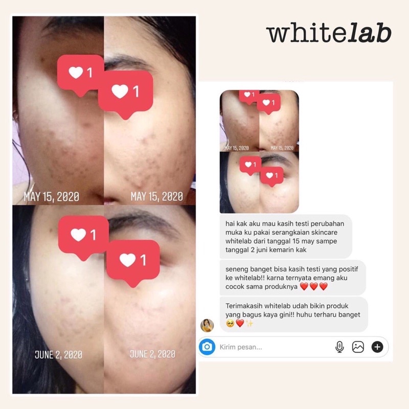 Whitelab Brightening Face Serum 20ML - Niacinamide 10%