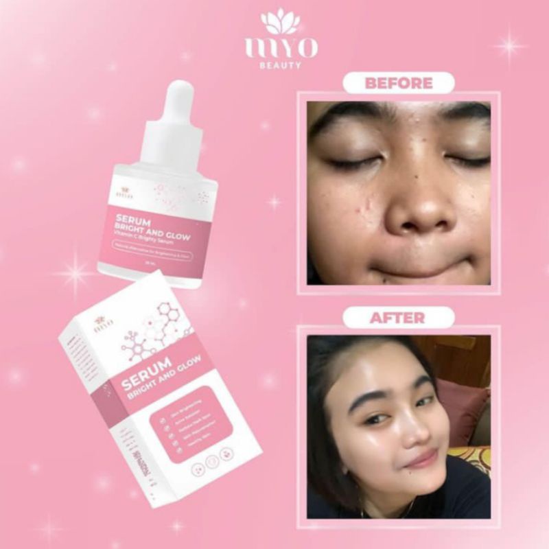 BPOM MYO MAYRA BRIGHT &amp; GLOW SERUM ISI 20 ML