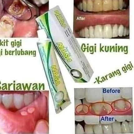 EXCLUSIVEPasta Gigi NASA - Odol Pemutih Gigi dan Penghilang Karang Gigi Pembersih Gigi Kuning Odol N