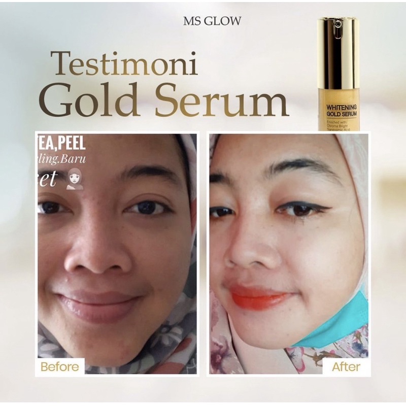 SERUM GOLD MSGLOW TERMURAH