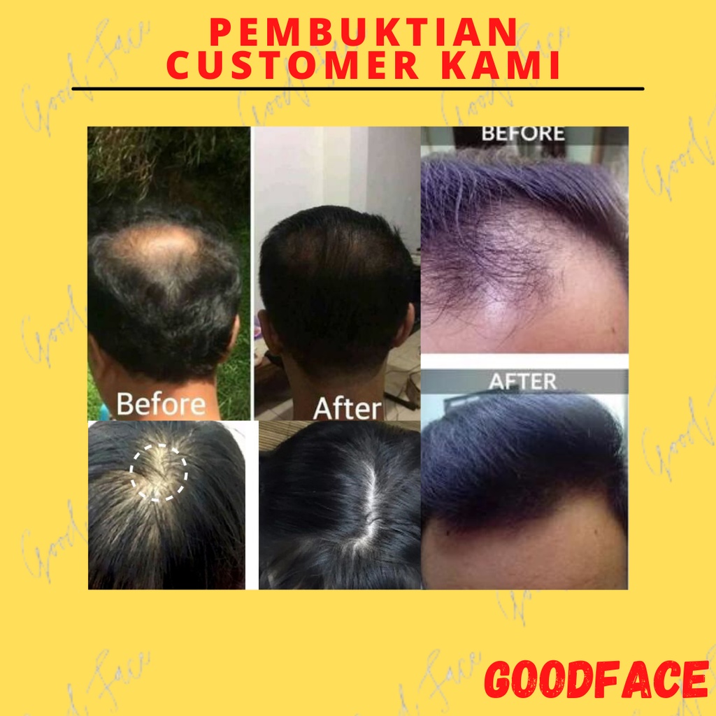 PENUMBUH RAMBUT BOTAK - BIO HERBAL GINSENG PAKET SHAMPOO - HAIR TONIC - PAKET BIO HERBAL 2IN1