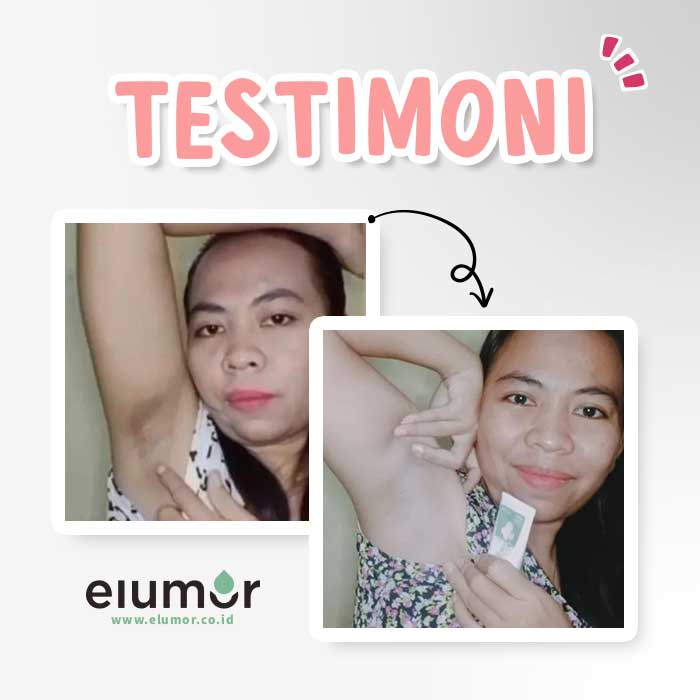 Elumor Oxter Gel New Formula &amp; Cream Pemutih Ketiak &amp; Pemutih Selangkangan Original