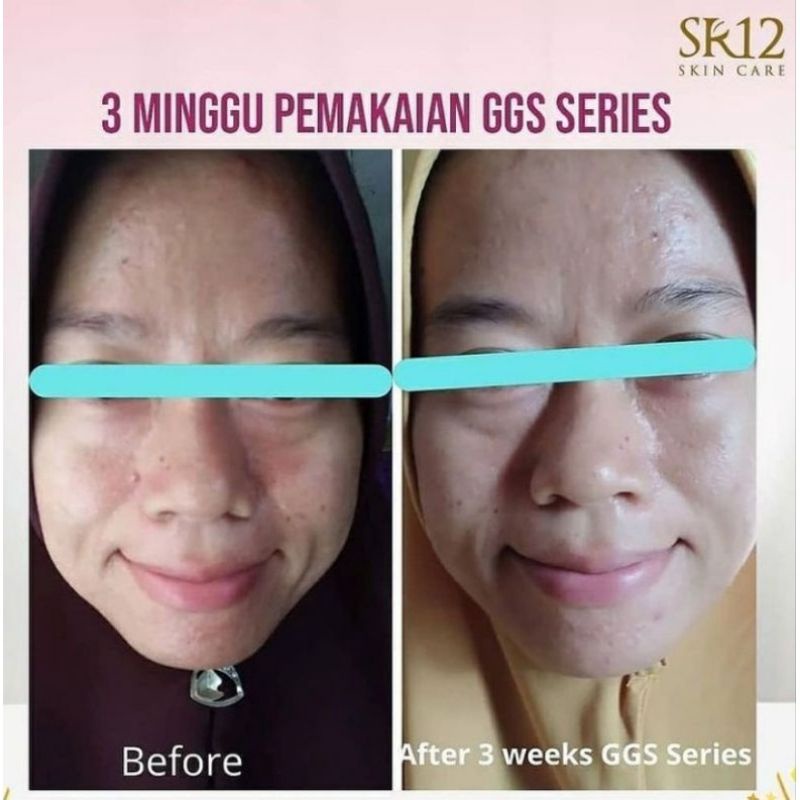 GGS SERIES GLOW GLASS SKIN SR12 HERBAL SKINCARE BPOM - KRIM GLOWING DALAM 1 MINGGU MENGHILANGKAN FLEK JERAWAT KRIM GLOWING KOREA PEMUTIH CEPAT ALAMI AMAN BPOM SKINCARE