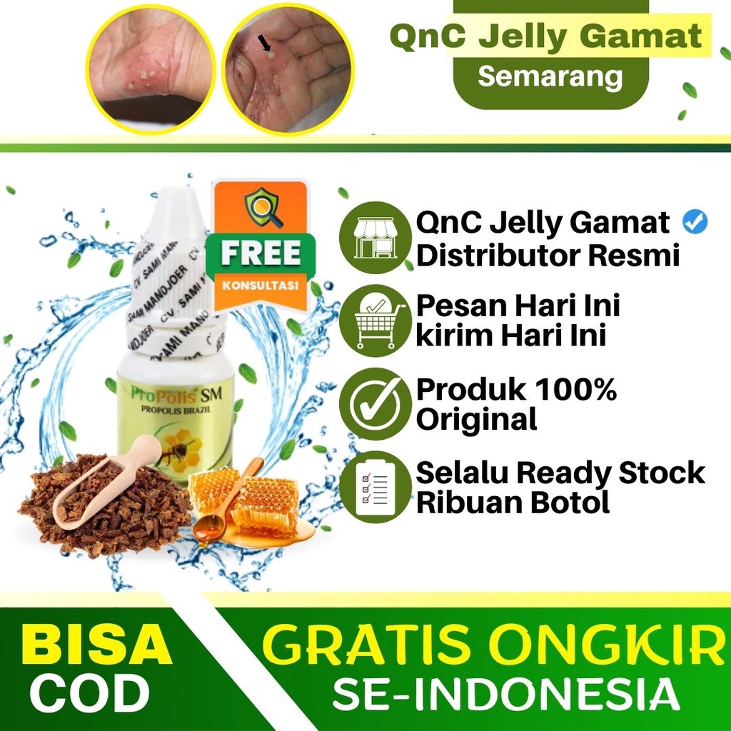 Obat Scabies Di Apotik, Scabies Manusia, Gatel Gatal Alergi, Obat Herpes Kulit, Obat Budug, Cenang B