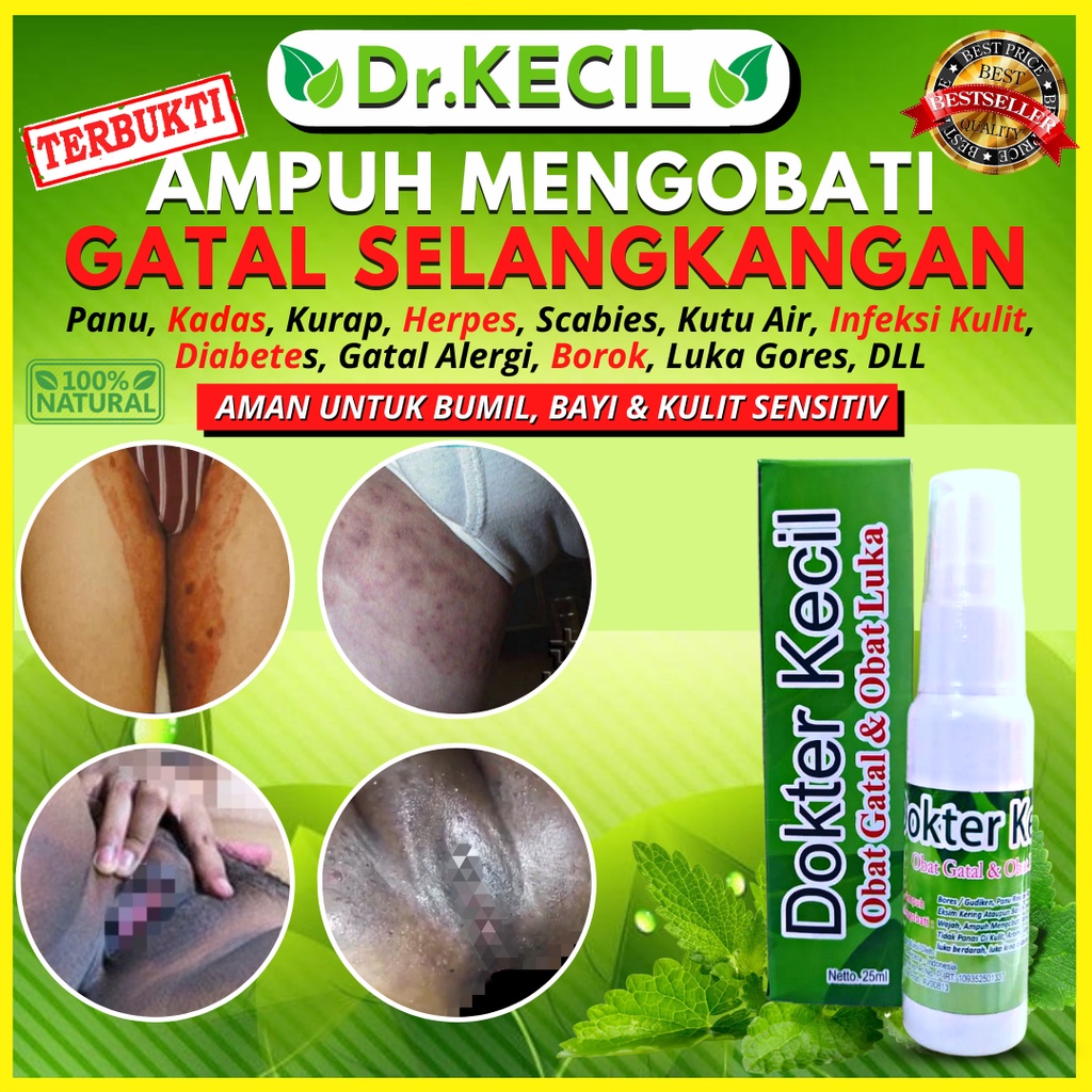 Obat Gatal Selangkangan Paling Ampuh Gatel Kulit Jamur Ampuh Obat Gatal Kulit Herbal
