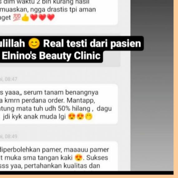 PAKET TANAM BENANG TANPA JARUM ELNINO'S BEAUTY CLINIC (V-SHAPE THERAPY)