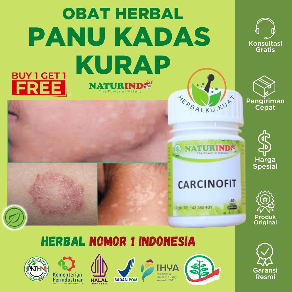 Obat Panu Paling Ampuh 100% Obat Panuan Kadas Kurap Ampuh Obat Kurap Paling Ampuh Obat Panu Paling A