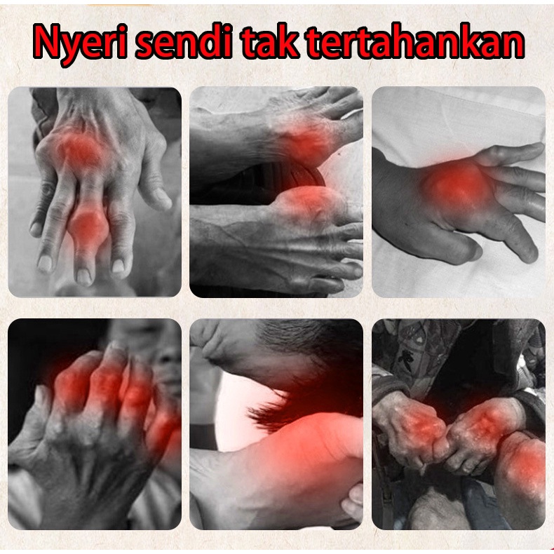 Salep Pereda Sakit Nyeri Sendi Otot Krim rematik Pereda Nyeri Pada Sendi 30g Herbal - Obat Nyeri Sendi Asam Urat Rematik Saraf Kejepit Sakit Pinggang Encok Kesemutan