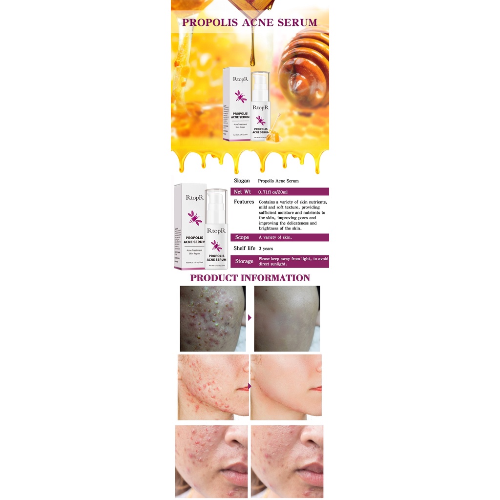 RtopR PROPOLIS Repair Acne Brightening Serum BRIGHTENING SERUM / JERAWAT / MENCERAHKAN