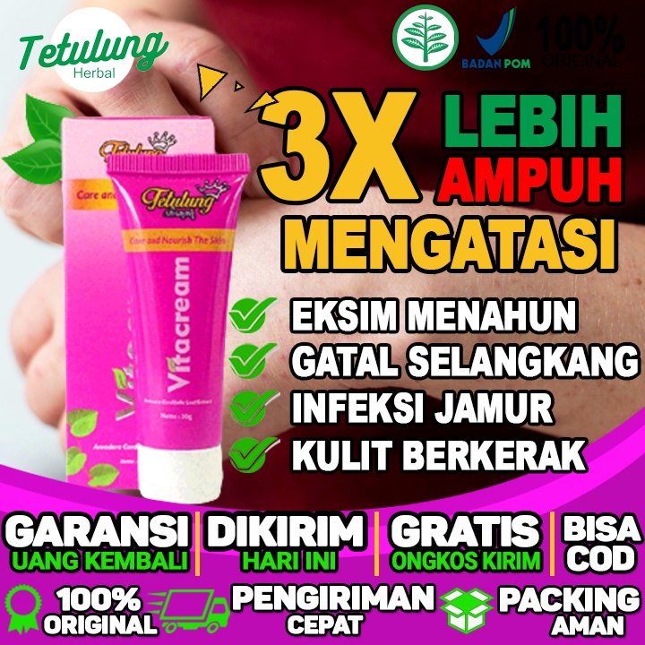 Obat Bisul Jenis  Salep Bisul Dan Jerawat  Salep Bisul Di Jari Tangan  eksim menahun ifeksi jamur