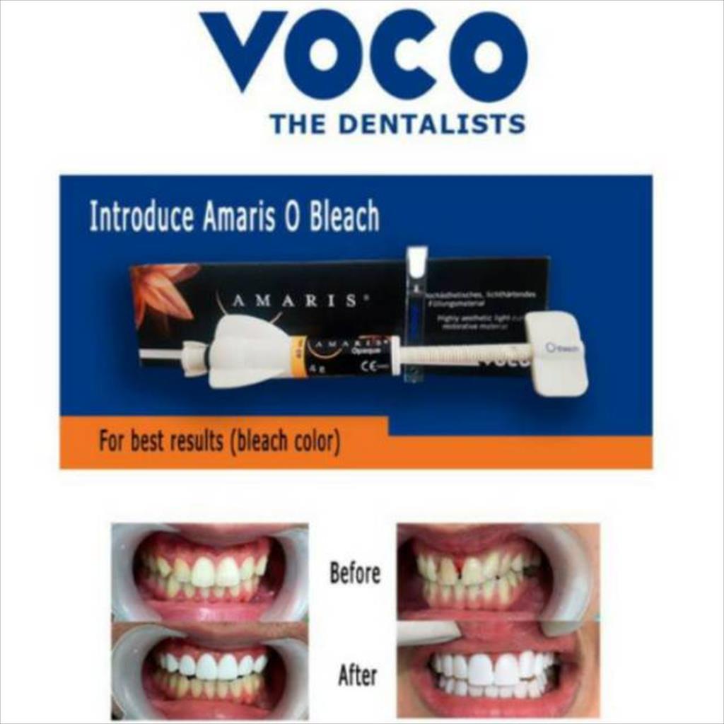 AMARIS VOCO O BLEACH VENEER COMPOSITE  EXTRA WHITE