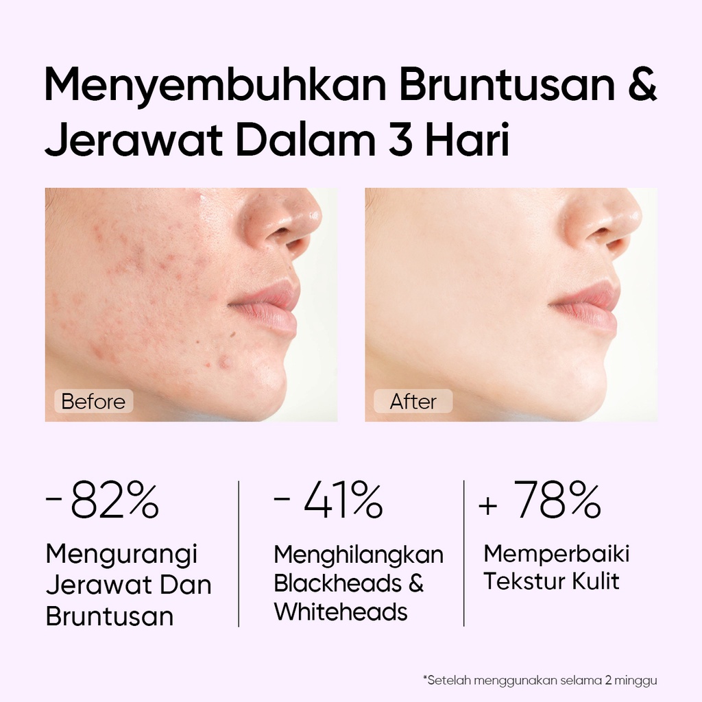 SKINTIFIC 2pcs Set | 5% AHA 5%BHA 1% PHA Exfoliating Toner 80ml + 2% Salicylic Acid Anti Acne Serum 20ml