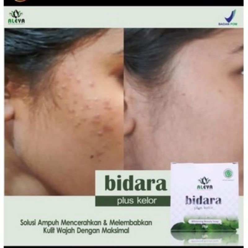 SABUN ALEYA BIDARA BPOM ASLI ORIGINAL 100% SABUN PENCERAH KULIT WAJAH