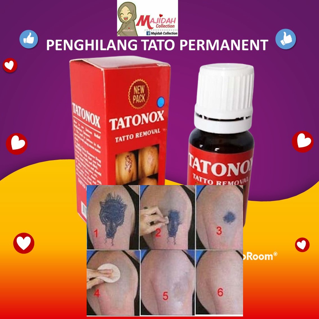 Penghilang Tato Permanen Tatto Removal Menghilangkan Semua Jenis Tatto Dengan Sekali Oles