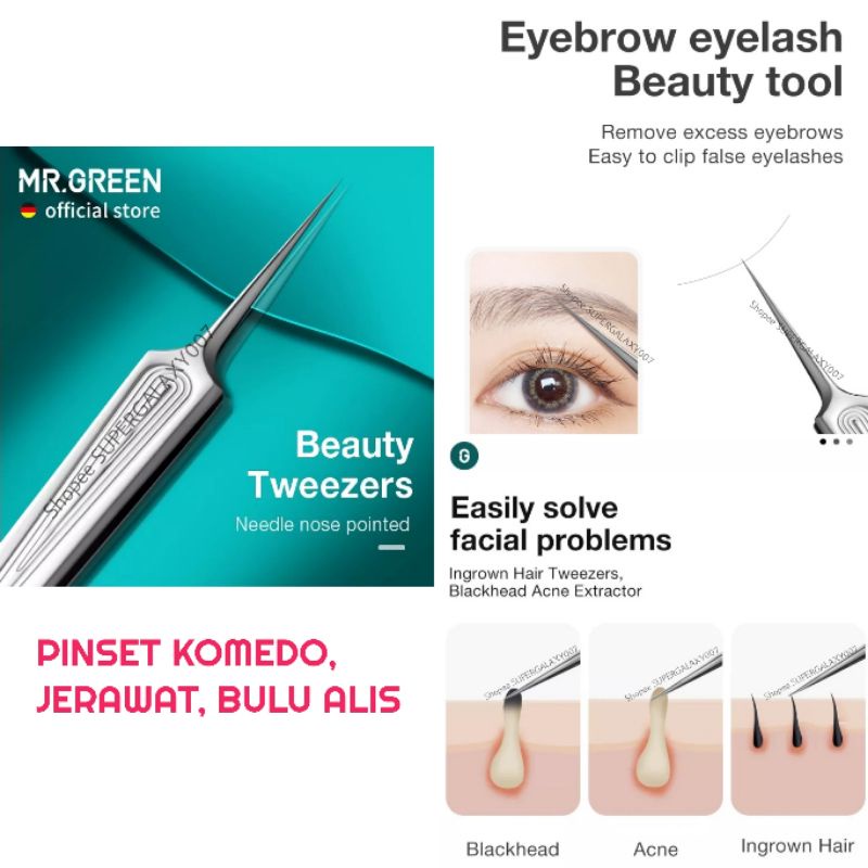 MR. GREEN Pinset Komedo Pinset Jerawat Pinset Alis mata Pinset Bulu Alis MR. GREEN Tweezers Acne Nee