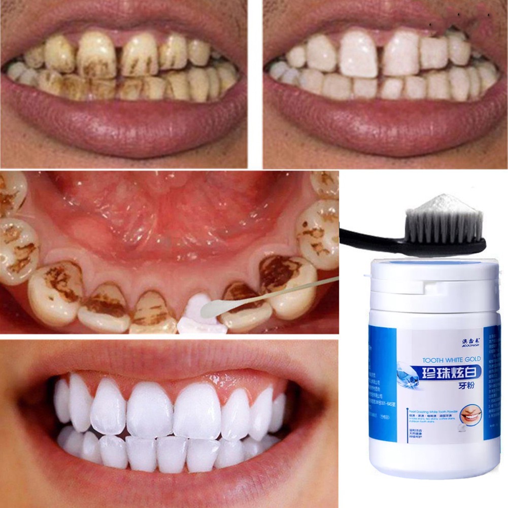 Pemutih Gigi/ Menghilangkan Gigi Kuning/ Menyegarkan Mulut/Pearl Whitening Bedak Gigi/Pemutih Gigi Kuning 50g—Teeth Whitening