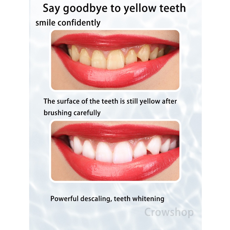 Pembersih Karang Gigi Sikat Gigi Elektrik 2In1 Dental Scaling Sonic Elektrik 3 Modes Perawatan USB Toothbrush Tooth Cleaner Whiten Teeth Tartar Remove Tool