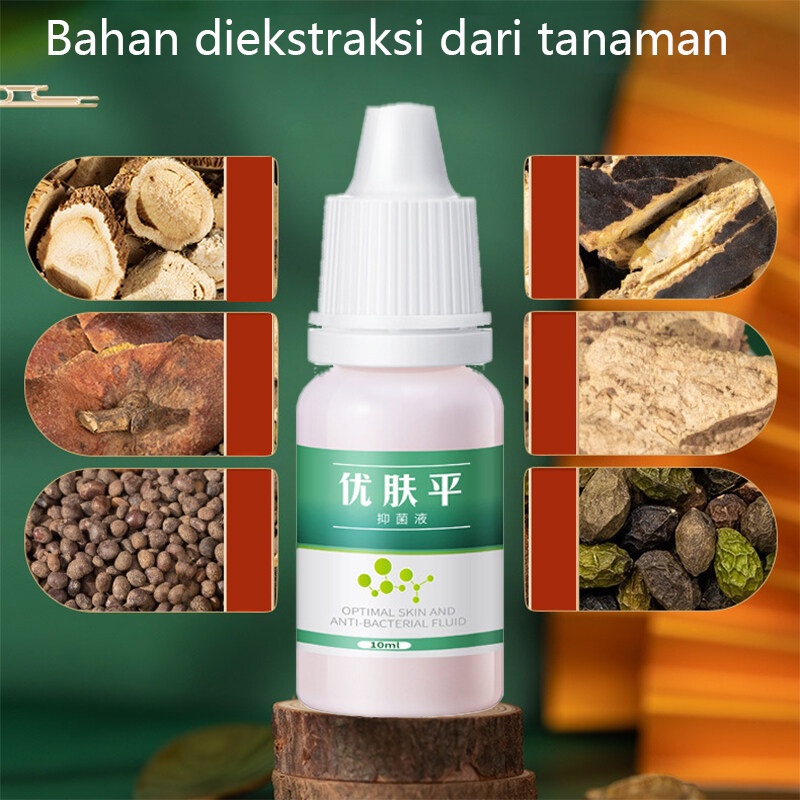 Cairan Obat Untuk Kutil Salep Untuk Kapalan Kaki Cairan Anti Kutil Tangan Dan Kaki Menghilangkan Kutil &amp; Skin Tag Cairan Antibakteri Obat Kutil 10ml Kapalan Di Tangan Dan Kaki Krim Antibakteri Penghilang Tahi Lalat