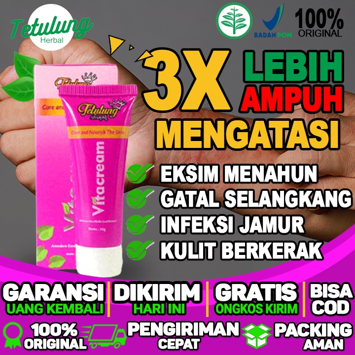 obat eksim yang paling bagus obat eksim yang paling ampuh untuk menghilangkan gatal selangkangan