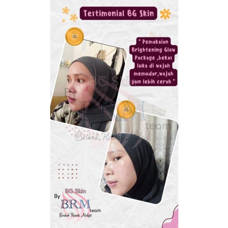 Image of BG SKIN Beauty Glow Skincare Paket Whitening Luxury Acne Luxury Brightening Glow Platinum #4
