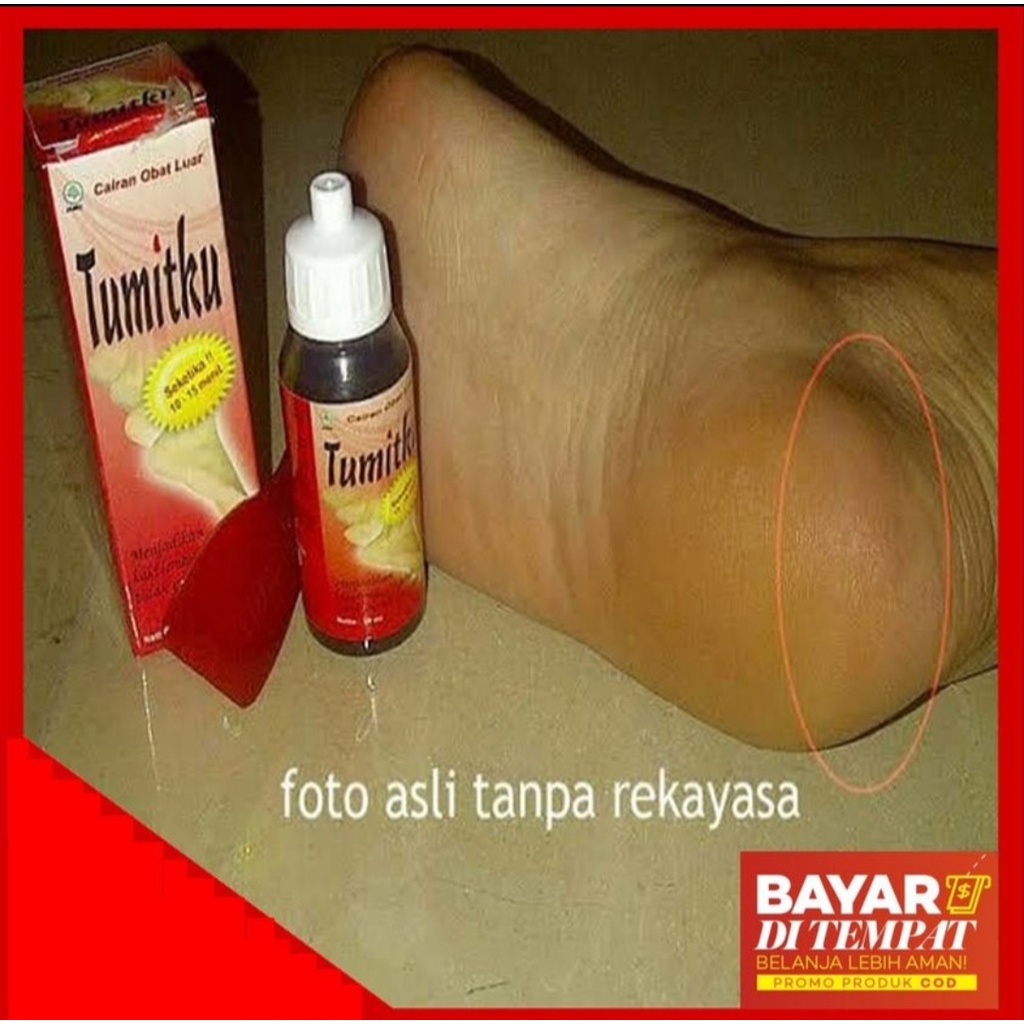 TUMITKU original Obat kaki pecah dan kering foot cream ampuh bpom original