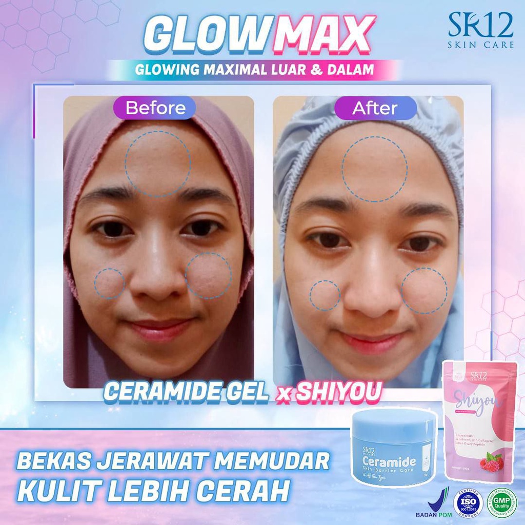 SR12 Ceramide Skin Barrier Care 18gr Pelembab Wajah Melembabkan Mencerahkan Kulit Muka BPOM