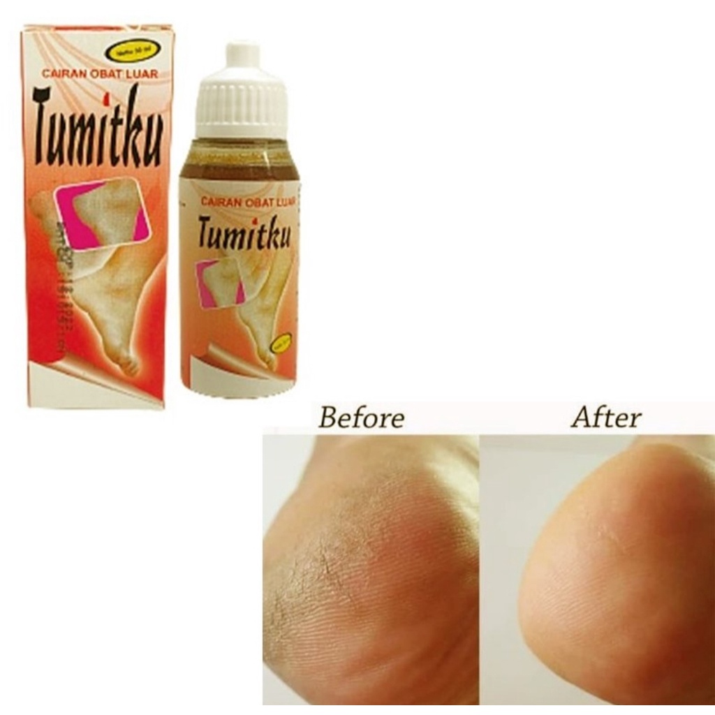 TUMITKU original Obat kaki pecah dan kering foot cream ampuh bpom original