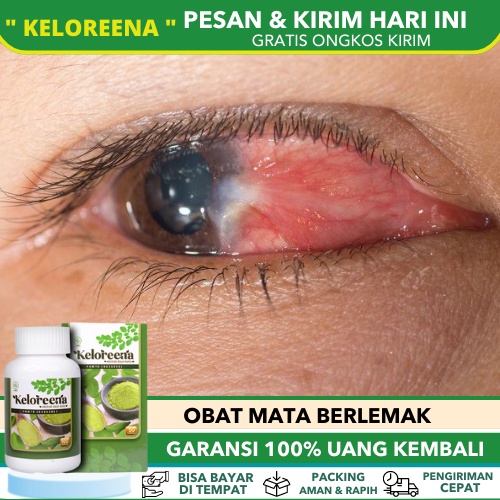 Jual Obat Mata Berlemak, Obat Mata Minus, Obat Mata Katarak, Obat Mata ...