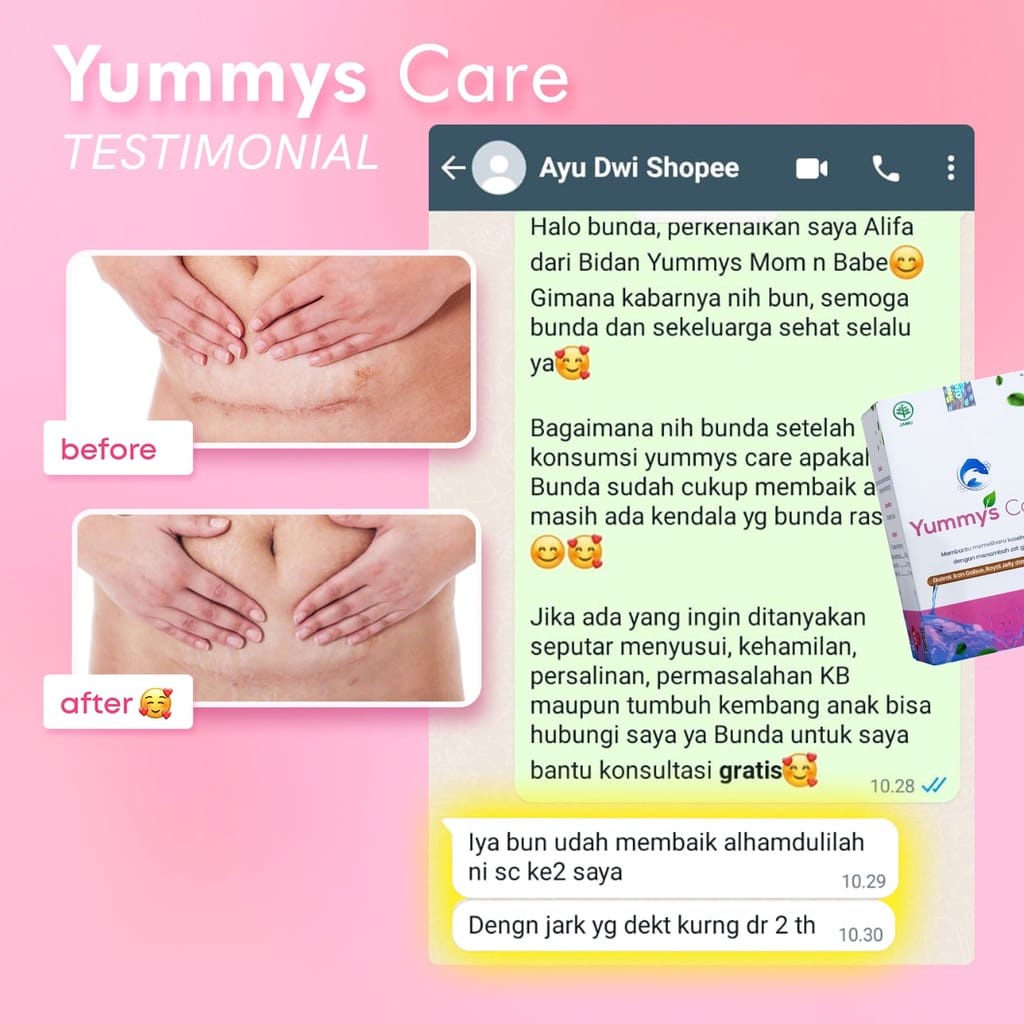 YUMMYSCARE Kapsul Kutuk Dengan Royal Jelly dan Bee Pollen | Obat Luka Pengering Operasi Pasca Melahirkan