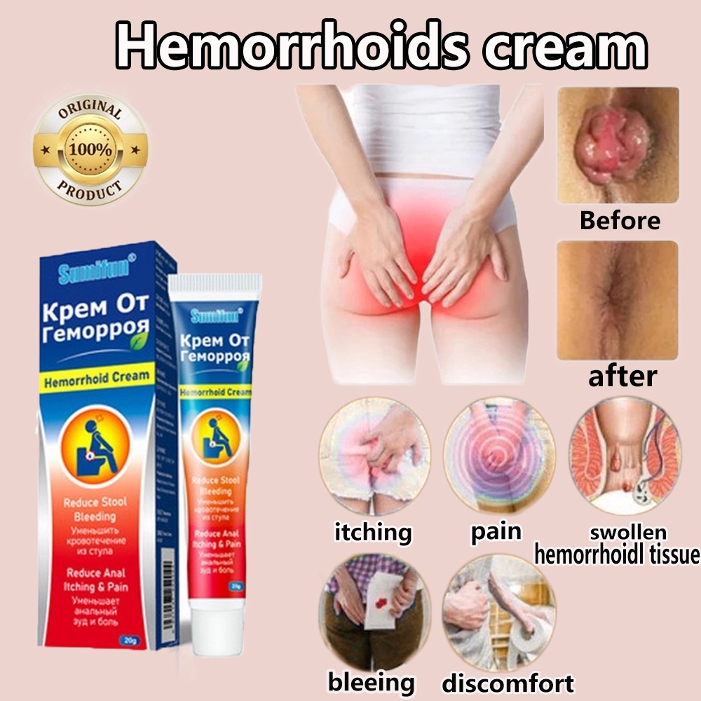 Krim Wasir Obat Wasir Salep Wasir Pengobatan Wasir Herbal Untuk Mengobati Wasir Internal Dan Ekstern