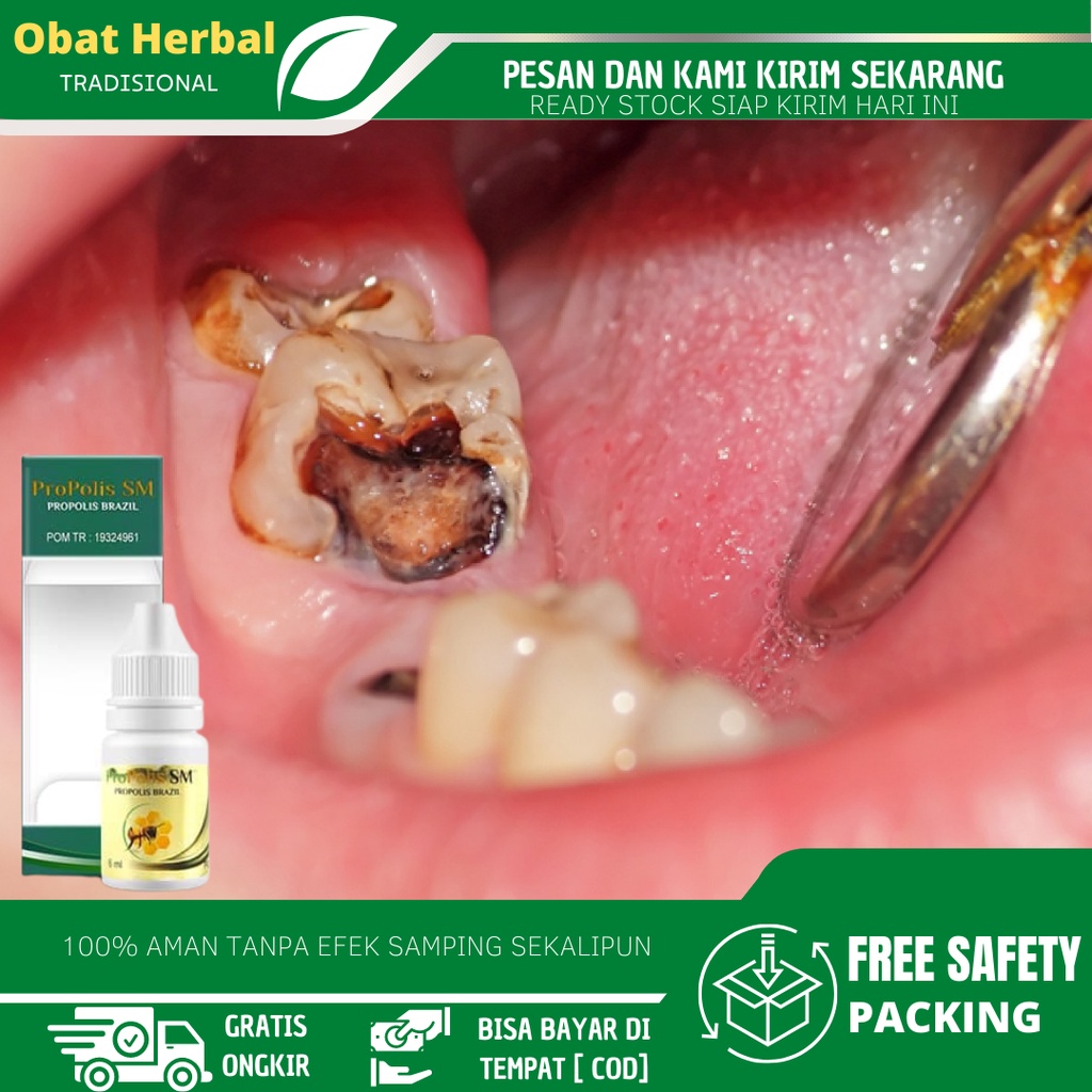 Obat Sakit Gigi Berlubang, Obat Gigi Bolong, Obat Sakit Gigi Nyut Nyutan, Obat Sakit Gigi dan Gusi, 