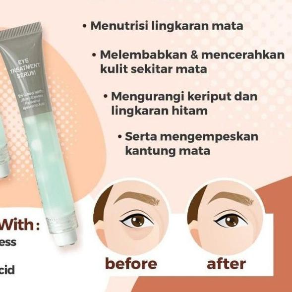 EYE CREAM MS GLOW ORI EYE DARK CIRCLE CREAM - CREAM MATA eye treatment ms glow