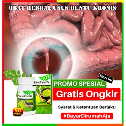 Obat herbal usus buntu kronis, Obat Penghilang usus buntu kronis, Obat alami usus buntu kronis, Obat