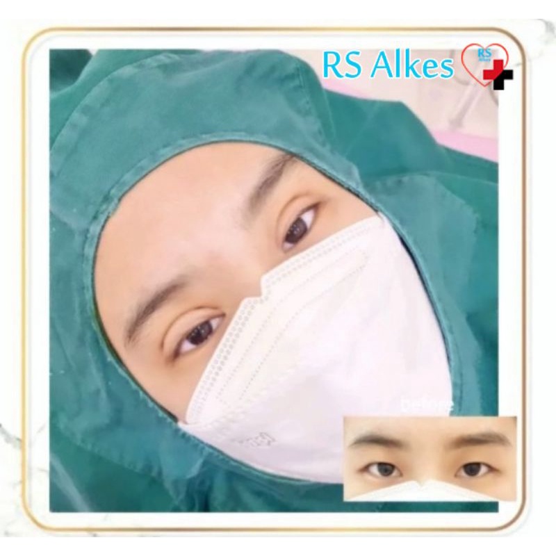 Duk Lubang Operasi Wajah 60x60 Duk Bolong Operasi 60 x 60