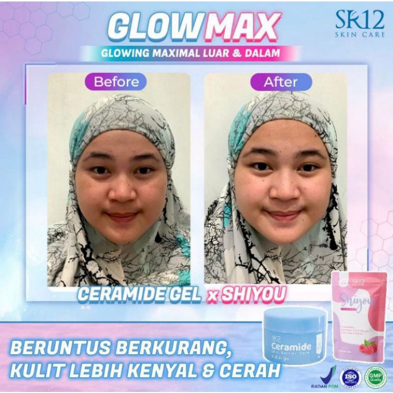 Ceramide Skin Barrier Care SR12 / Glowing Maximal / Pelembab wajah semua jenis kulit / Moisturizer / Cream wajah glowing / Krim wajah / kulit berminyak / kulit kering / Flek hitam / Jerawat / Shiyou Collagen Drink / Skincare SR12 / Perawatan Wajah SR12