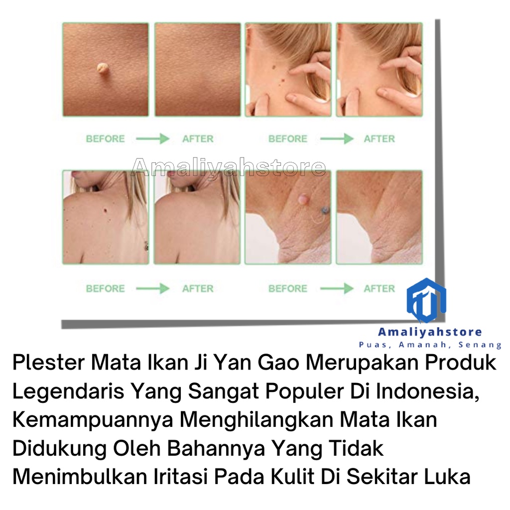 Plester Mata Ikan Obat Kapalan Kutil Dan Mata Ikan Di Kaki Tangan Leher Plester Ji Yan Gao Hansaplast Mata Ikan Untuk Penghilang Tahi Lalat Ampuh Skin Tag Remover Cream Permanen
