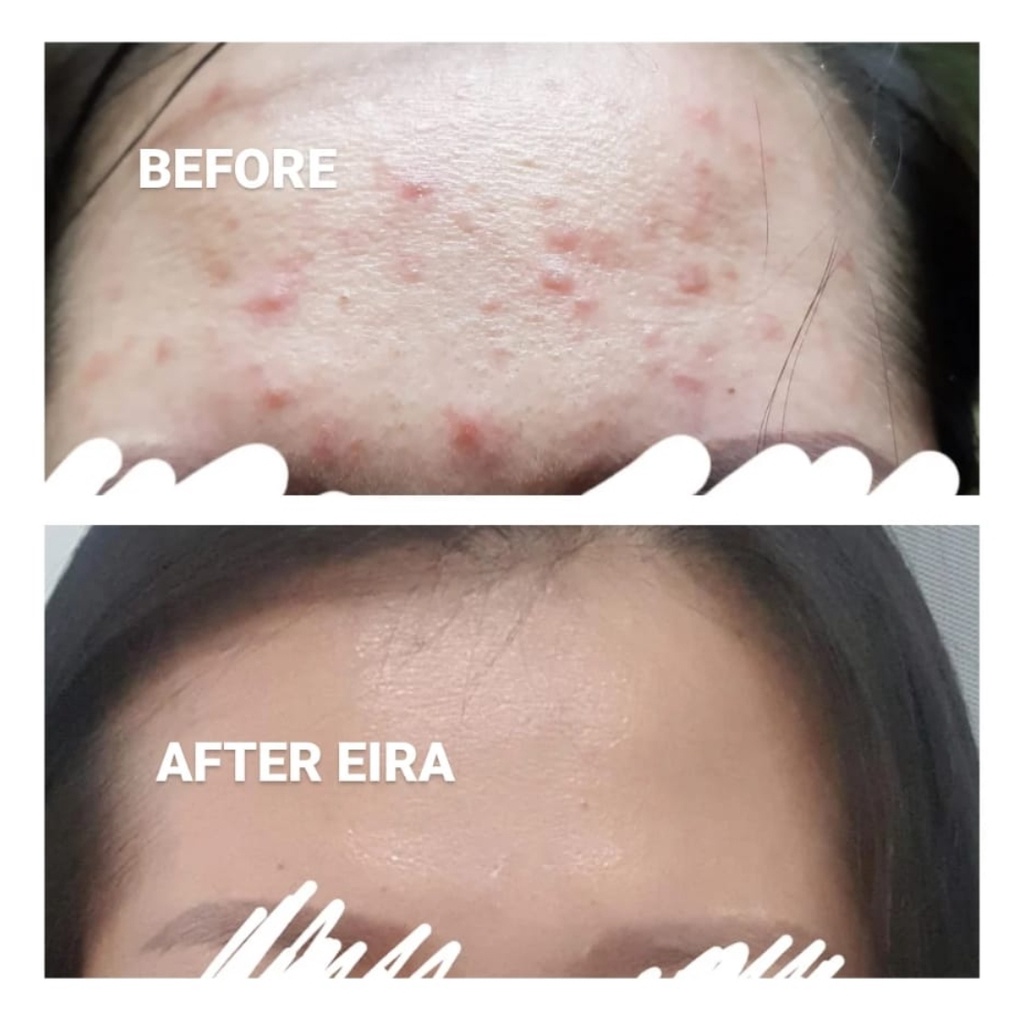 EIRA Skincare by Susan Barbie | Cleanser | Toner | Glow Serum | Refining Day Cream | Glow Hydragel Night Cream| Sunblock