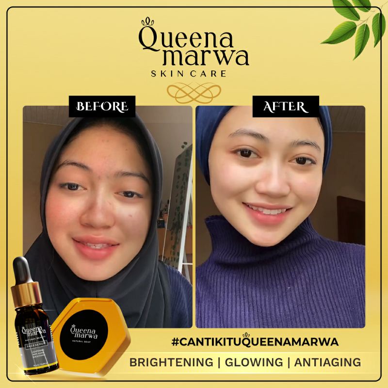 Queena Marwa Face Serum Aman BPOM 50 gr Original Terjangkau