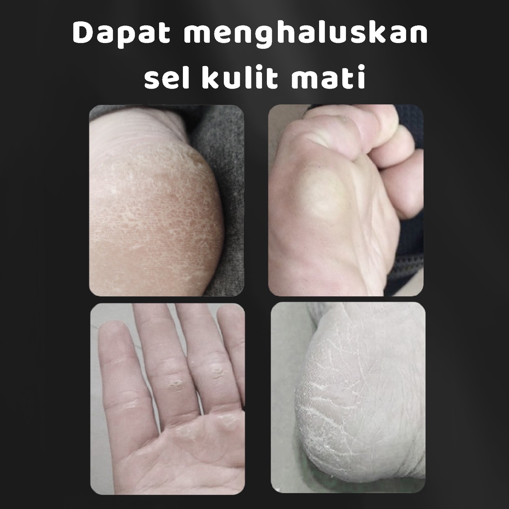 Pretty Set Alat Perawatan Kuku Kaki Manicure Pedicure/Mencegah Kulit Mati/Pembersih Tumit Pecah/Perawatan Kecantikan Profesional Foot Care