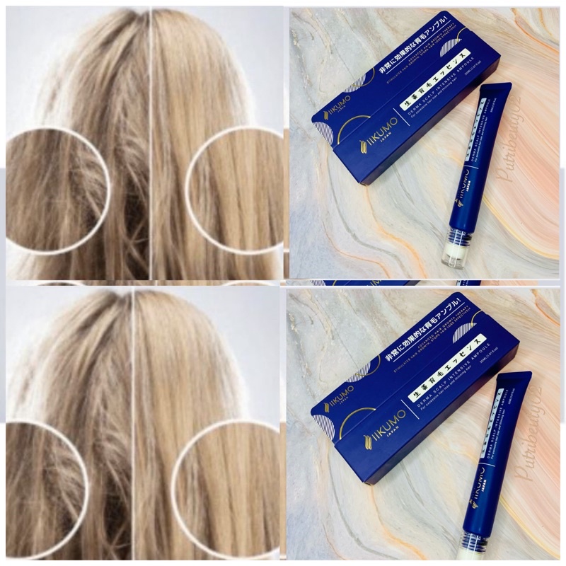 COD PROMO IIKUMO Penumbuh RAMBUT RONTOK DAN RAMBUT TIPIS TERLARIS