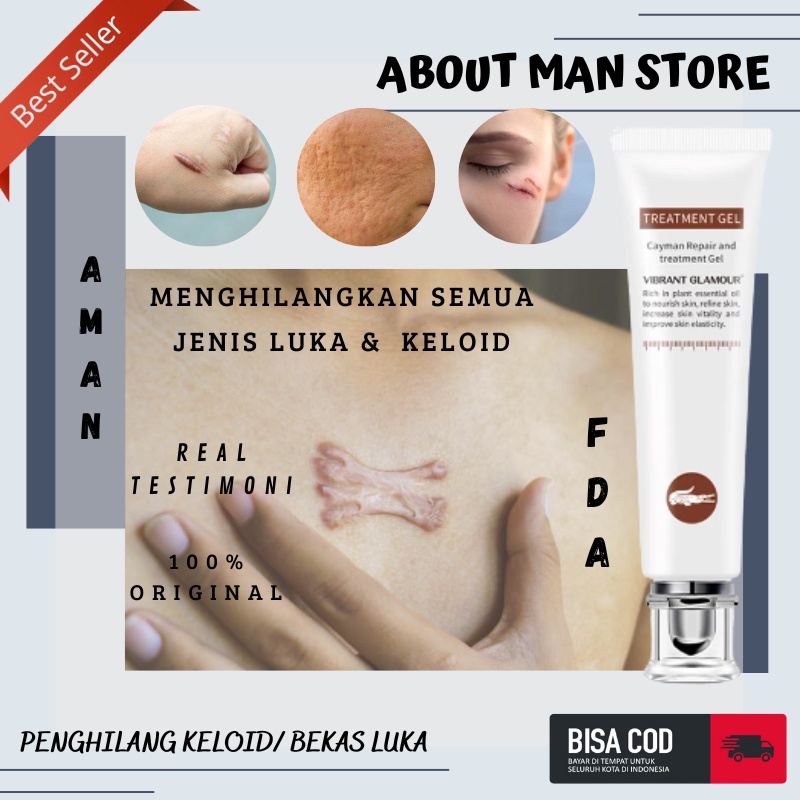 Jual [about Man] Krim Obat Penghilang Keloid Salep Keloid Daging Tumbuh