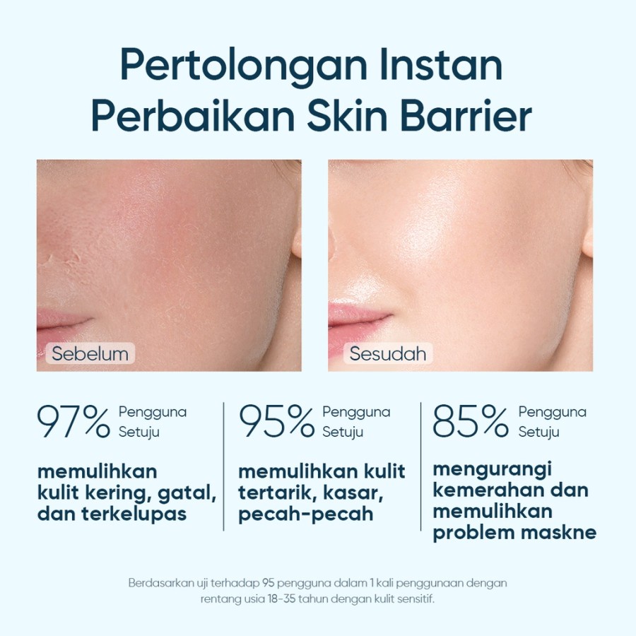 SKINTIFIC Masker Wajah 5X Ceramide Soothing and Repairing Mask Sheet Mask untuk Kulit Kering Kasar Kemerahan Mengelupas