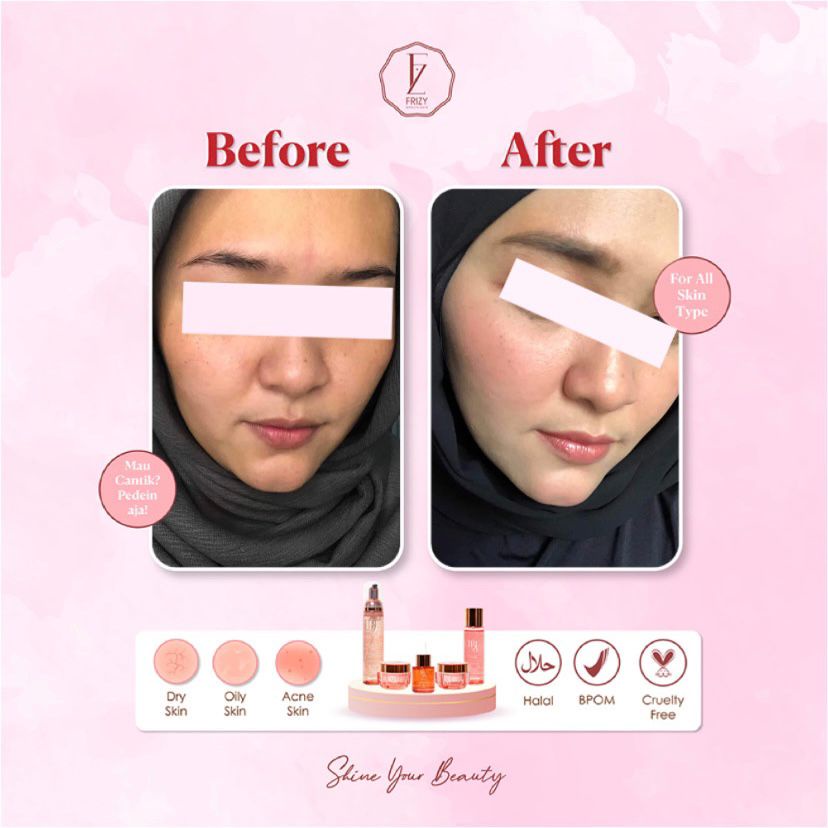 Paket Frizy BB Glow Brightening  Series Skincare Pencerah glowing BPOM HALAL