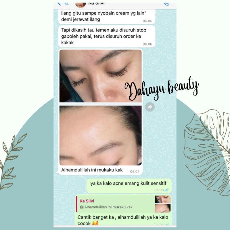 PAKET ACNE WHITENING SUPER