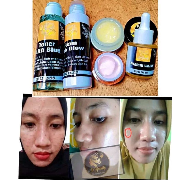 SS'BEAUTY SKINCARE/SKINCARE PEMUTIH WAJAH/SKINCARE JERAWAT/SkINCARE KERIPUT/SKINCARE GLOWING