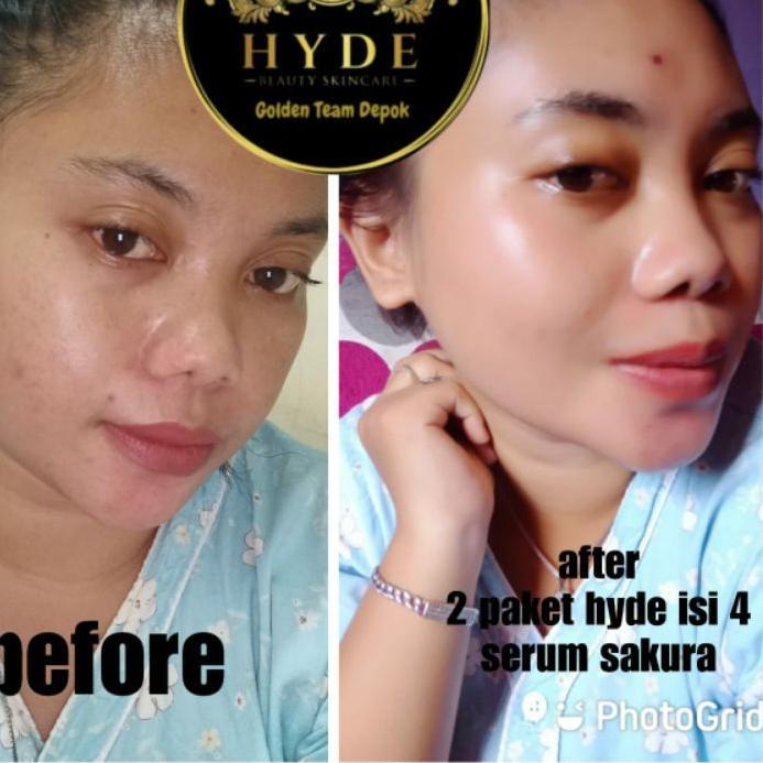 Miliki HYDE SKINCARE ORIGINAL SEMUA PAKET DAN ECER HYDE SKINCARE  SEMUA VARIANT PERAWATAN KULIT WAJA