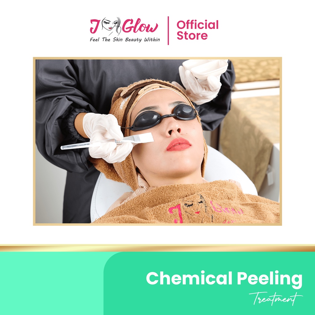 J-GLOW - Treatment Chemical Peeling Acne (Jglow Aestehtic Clinic)