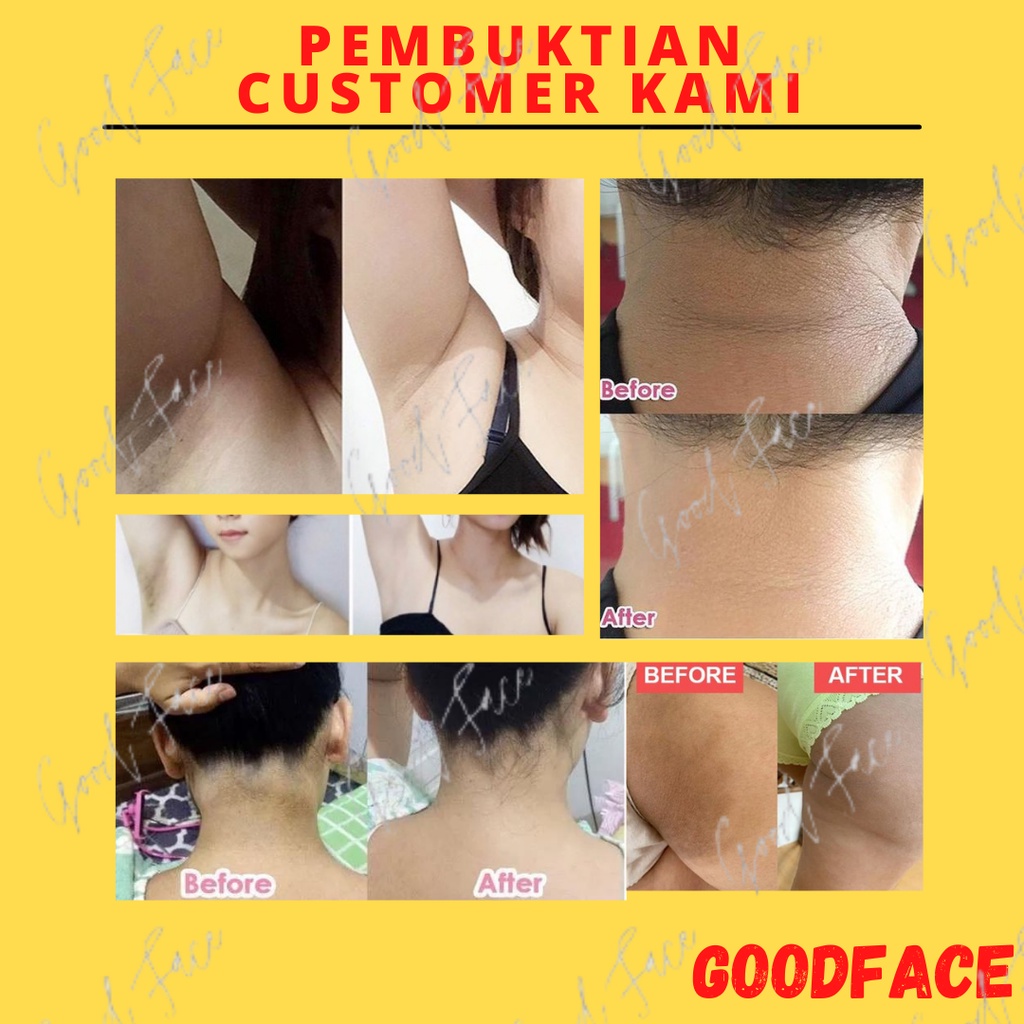 CREAM PENCERAH KETIAK SHINKURIM PEMUTIH SELANGKANGAN PEMUTIH BADAN PERMANEN PERAWATAN TUBUH